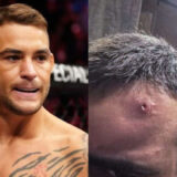 « Que des belles paroles » : Dustin Poirier doute des justifications de Benoit Saint-Denis