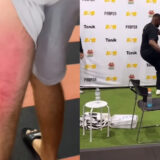 Jon Jones : un fan finit en béquilles après lui avoir demandé un coup de pied