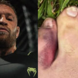 Forfait à cause de son orteil, Conor McGregor donne les conditions de son retour