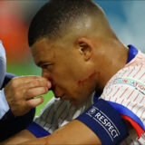 Euro 2024 : Kylian Mbappé prend la parole après sa fracture au nez