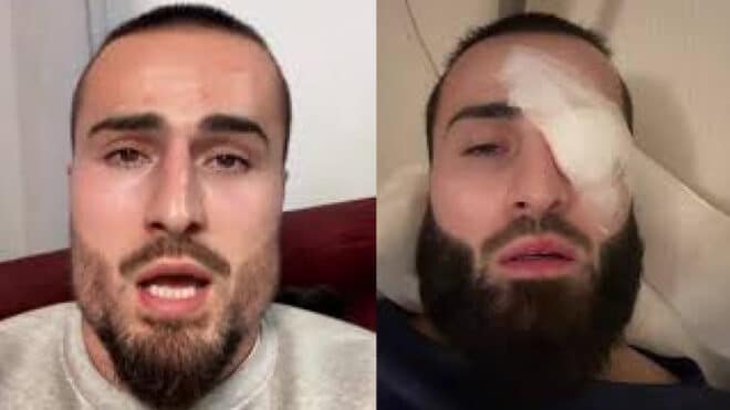 « J’ai failli laisser tomber » : IbraTV revient sur son problème à l’œil avant ses débuts en MMA