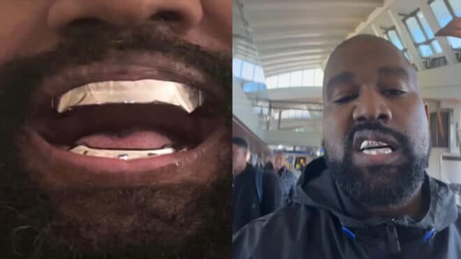 Kanye West au plus mal à cause de son grillz, il mène son dentiste en justice