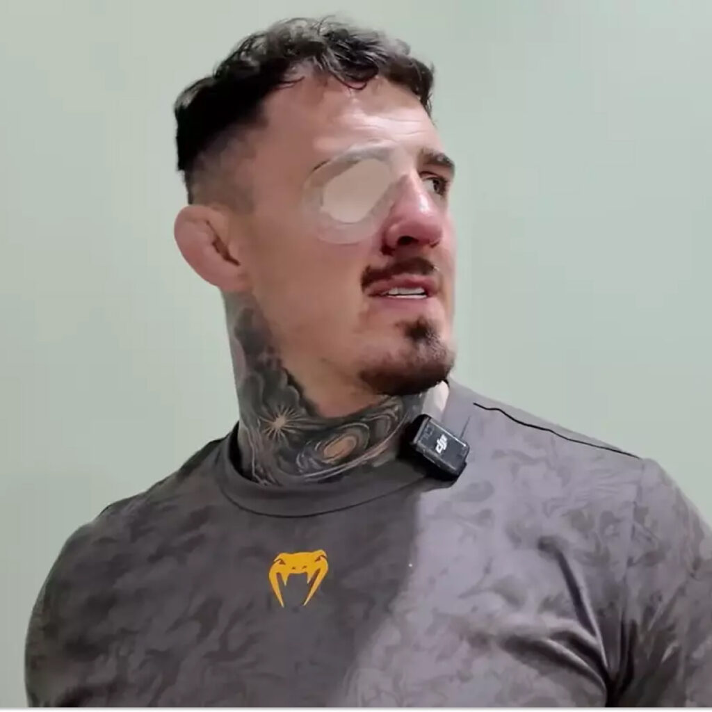 Après avoir reçu un doigt dans l’oeil en affrontant Ciryl Gane, Tom Aspinall pourrait ne plus jamais combattre